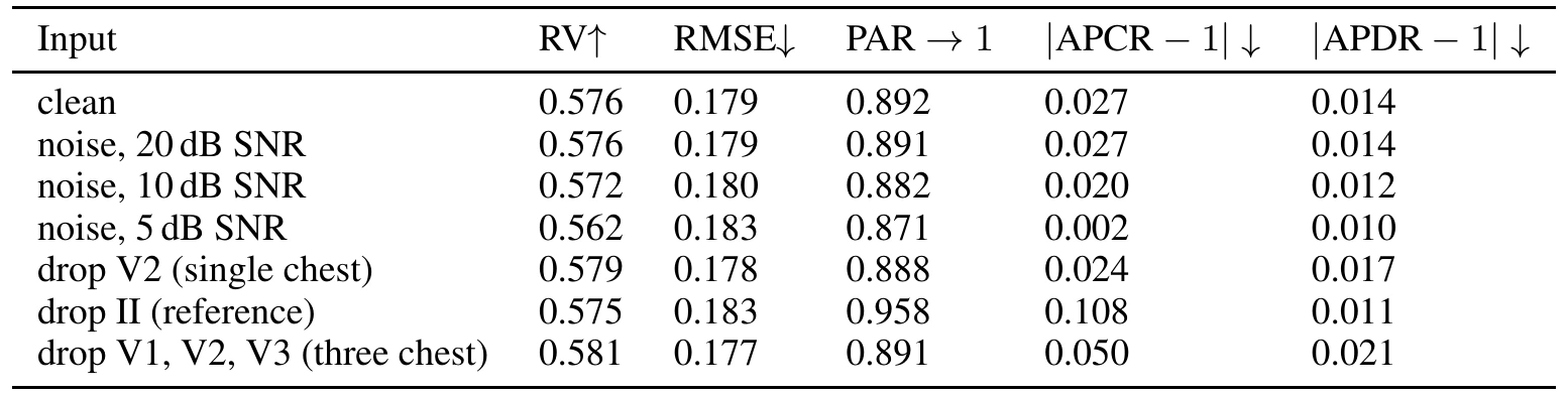 Table of RV, RMSE, PAR, |APCR−1| and |APDR−1| for clean input, noise at 20, 10 and 5 dB SNR, and dropped leads V2, II and V1 to V3. Dropping lead II raises |APCR−1| from 0.027 to 0.108.