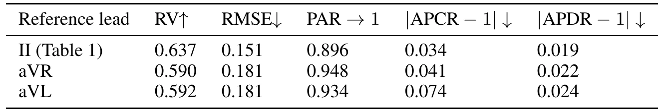 Table of metrics for reference leads II, aVR and aVL. Lead II: RV 0.637, RMSE 0.151, PAR 0.896, |APCR−1| 0.034, |APDR−1| 0.019. aVR and aVL have lower RV and higher RMSE.